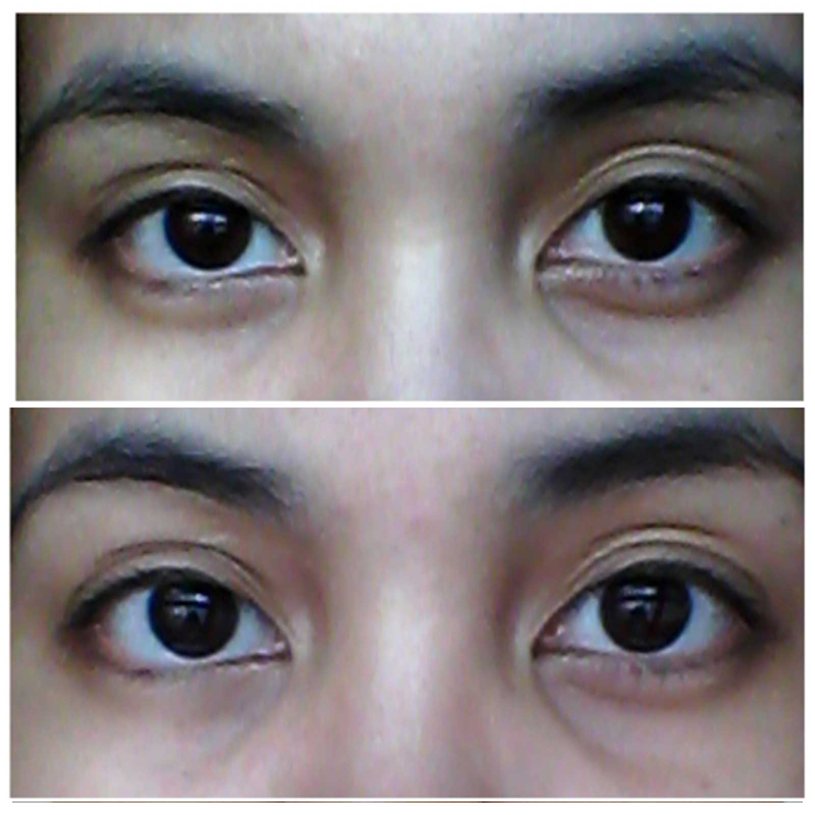 قبل-و-بعد-استخدام-كريم-العين