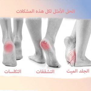 مشكلات-القدم-و-كيفية-علاجها